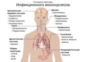 Мононуклеоз ли это?