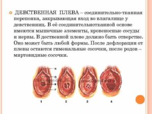 Может ли сохраниться девственность, не до конца прорваться плева?