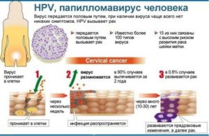 Можно ли при помощи поднятия иммунитета удалить впч из организма