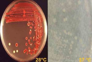 В зеве обнаружили бактерию serratia liquefaciens