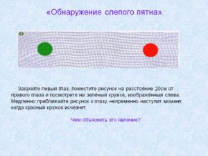 Находясь на улице появляются точке в правом глазу