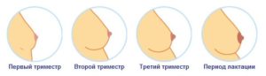 Возможна ли повышенная чувствительность сосков в конце цикла?