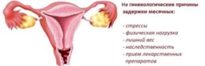 Чем может быть вызвана задержка менструации?