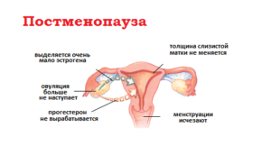 Месячные и климакс