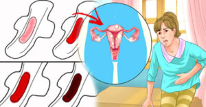 Менструация три раза подряд