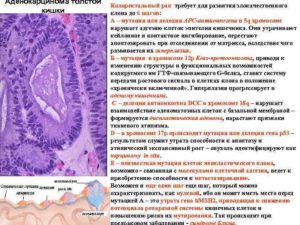 Диета при аденокарциноме сигмовидной кишки