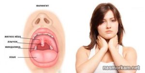 Воспаление языка и боли в горле