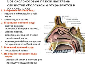 Вросшая ячейка решётчатой кости правой лобной пазухи