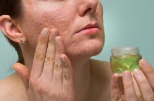 Эффективное лечение проблемной кожи с помощью гомеопатии