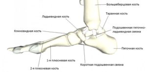 Воспаление на таранной кости