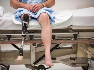 Возможно ли получить инвалидность с такой травмой колена?