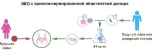 Донорство яйцеклетки и беременность