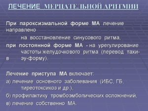 Что эффективнее принимать при пароксизме мерцательной аритмии