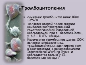 Высокие тромбоциты лечение