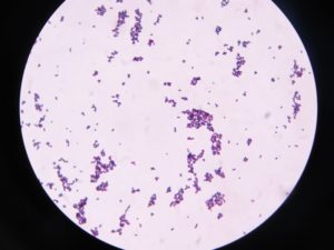 Микроскопическое (бактериоскопическое) исследование мазка, окрашенного по Граму (Gram Stain. Bacteri