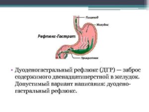 ДГР, прокинетики не действуют