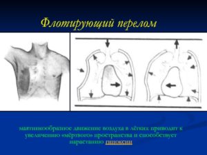 Движение воздуха в лёгком