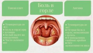 Долгое время болит горло и ощущение инородного тела в глотке