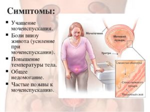 Частые позывы в туалет, боли в области живота