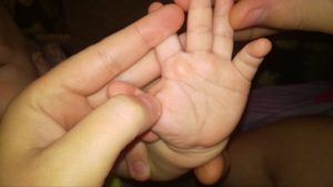 Мягка шишка на руке ребенка