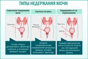 Мочеиспускание при смехе