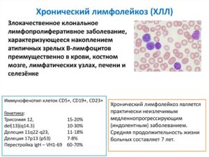 В-ХЛЛ В-лимфоцитарная лимфома/ В-ХЛЛ