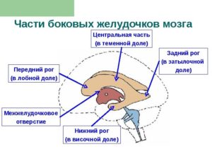 Дистанция затылочных рогов боковых желудочков