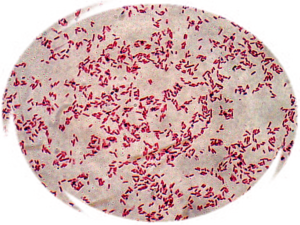 В мазке из глаз обнаружена Escherichia coli. Насколько это серьёзно?
