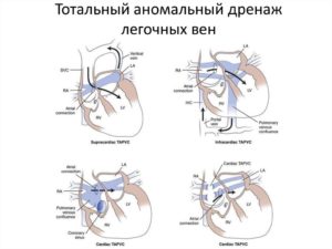 Венозный дренаж