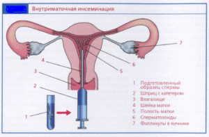 Можно ли забеременеть от спермы на руке? Или