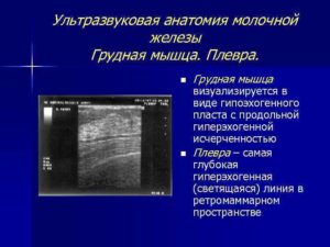 УЗИ молочных желез. Региональный лимфоотток: единичные измененной эхоструктуры