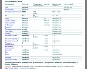 Частое обильное мочеиспускание, кетоны в моче, повышен ТТГ