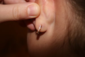 Воспаление мочки уха на месте прокола