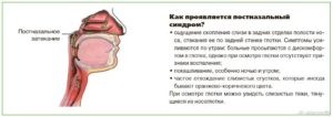 Выделения скапливаються и стекают по задней стенки глотки