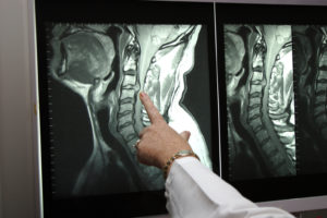 Можно ли делать рентген грудного отдела позвоночника при мастопатии?