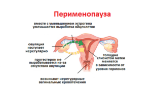 Месячные и климакс