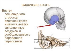 Нарушение пневматизации пирамид и сосцевидных отростков