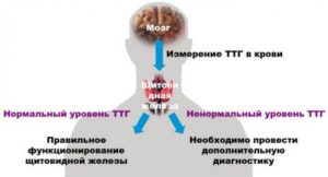 Набор веса при низком ТТГ