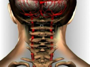 Нарушение кровотока в шейном отделе