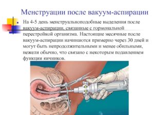 Менструальноподобные выделения