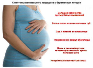 Молочница при беременности на сроке 14-15