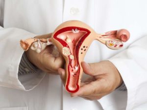 Эндометриоз и зачатие
