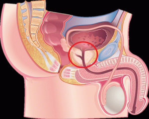Может ли не быть простаты у мужчины?