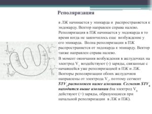 Нарушение процессов реполяризации ЛЖ, ВДСУ