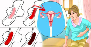На фоне Сустена на 6 сутки пошли менструации