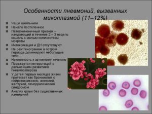 Микоплазма пневмони