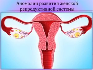 Менструация в день свадьбы