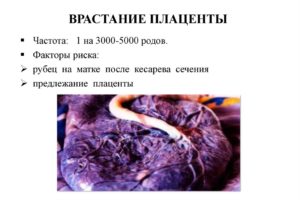 Врастание плаценты