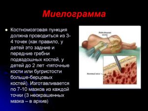 Миелограмма