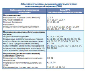 Впч 39 и 56 подскажите